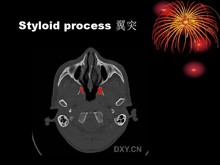 Styloid process 翼突 