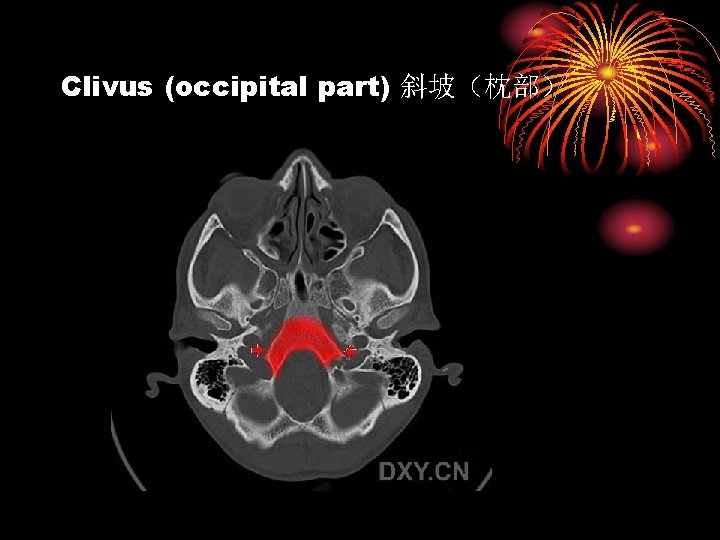 Clivus (occipital part) 斜坡（枕部） 