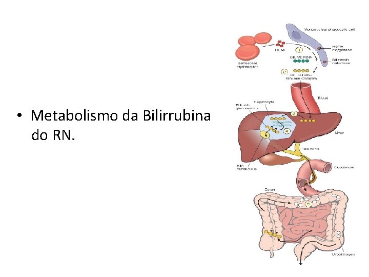  • Metabolismo da Bilirrubina do RN. 