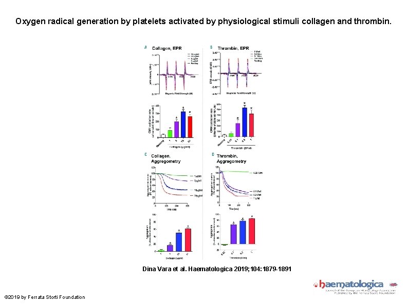 Oxygen radical generation by platelets activated by physiological stimuli collagen and thrombin. Dina Vara