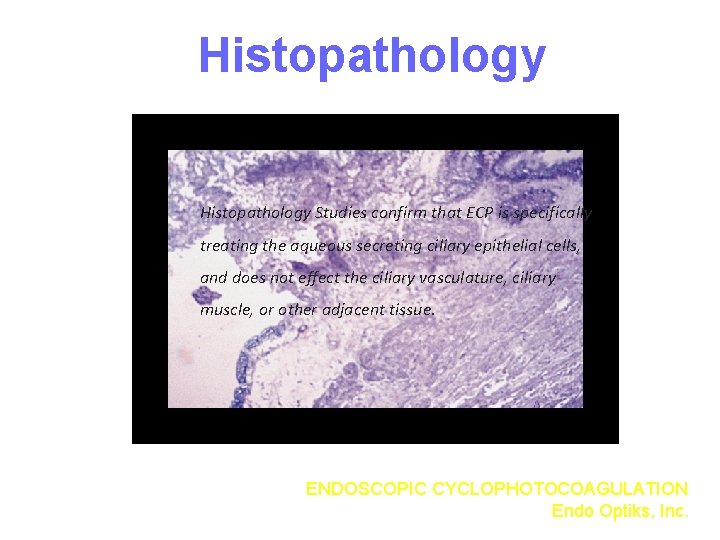 Histopathology Studies confirm that ECP is specifically treating the aqueous secreting ciliary epithelial cells,