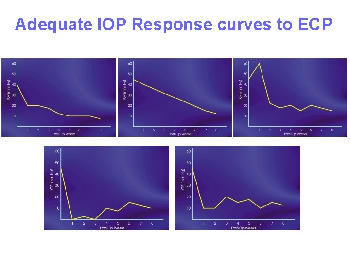 Adequate IOP Response curves to ECP 