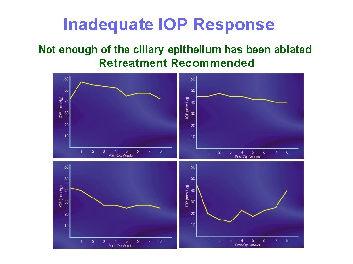 Inadequate IOP Response Not enough of the ciliary epithelium has been ablated Retreatment Recommended