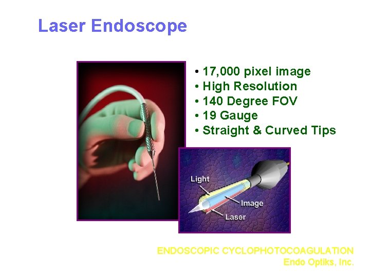 Laser Endoscope • 17, 000 pixel image • High Resolution • 140 Degree FOV