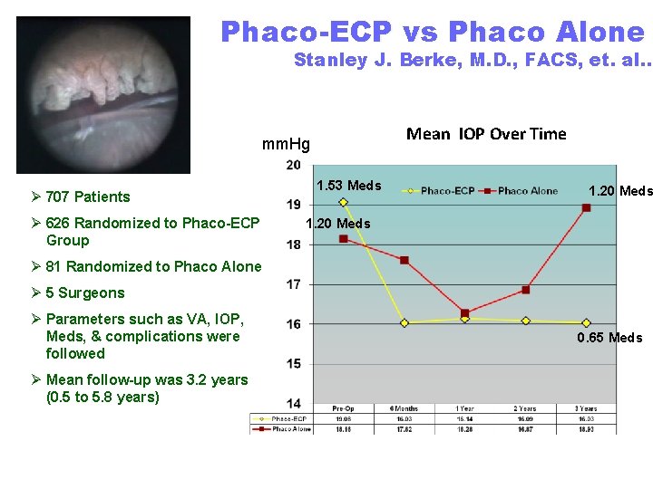Phaco-ECP vs Phaco Alone Stanley J. Berke, M. D. , FACS, et. al. .