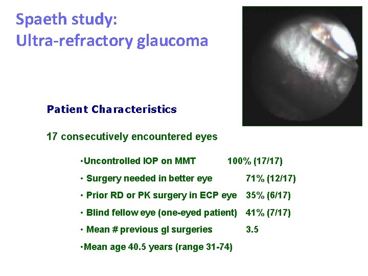 Spaeth study: Ultra-refractory glaucoma Patient Characteristics 17 consecutively encountered eyes • Uncontrolled IOP on