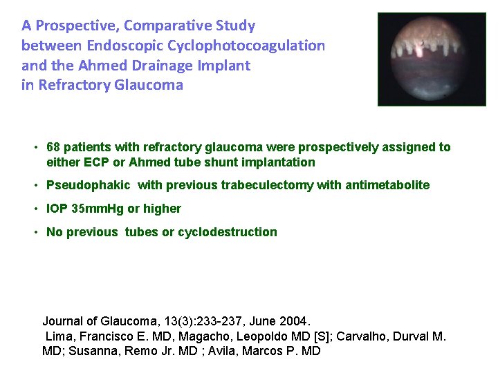 A Prospective, Comparative Study between Endoscopic Cyclophotocoagulation and the Ahmed Drainage Implant in Refractory