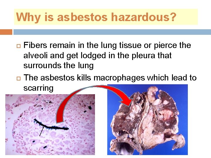 Why is asbestos hazardous? Fibers remain in the lung tissue or pierce the alveoli