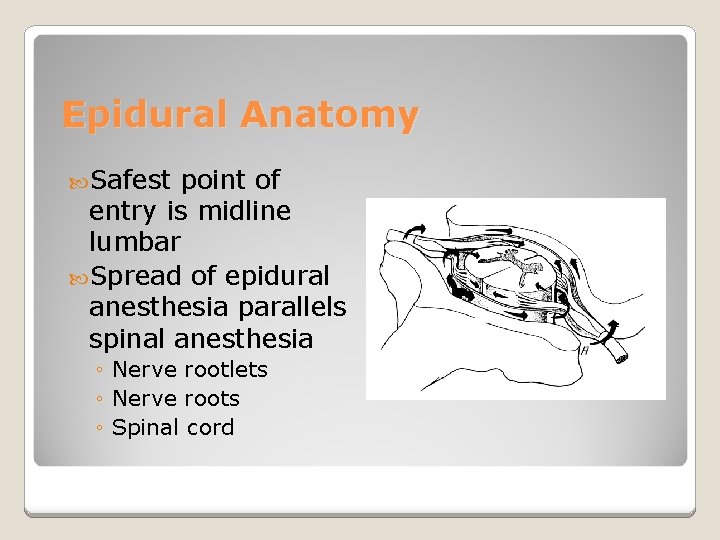 Epidural Anatomy Safest point of entry is midline lumbar Spread of epidural anesthesia parallels