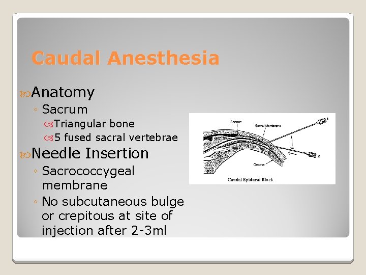 Caudal Anesthesia Anatomy ◦ Sacrum Triangular bone 5 fused sacral vertebrae Needle Insertion ◦