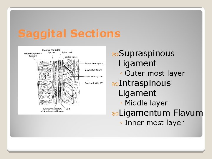 Saggital Sections Supraspinous Ligament ◦ Outer most layer Intraspinous Ligament ◦ Middle layer Ligamentum