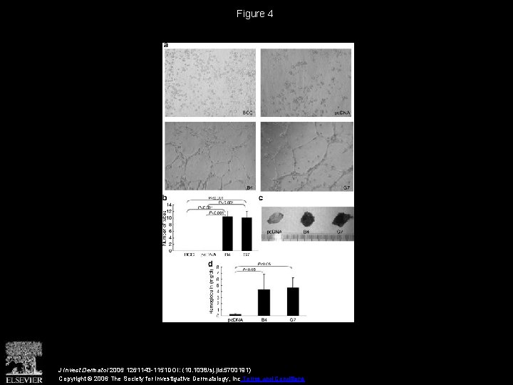 Figure 4 J Invest Dermatol 2006 1261143 -1151 DOI: (10. 1038/sj. jid. 5700191) Copyright