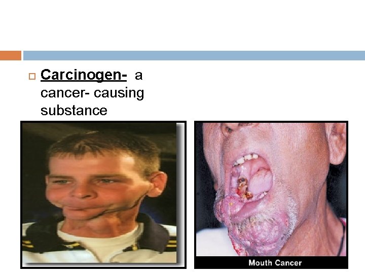  Carcinogen- a cancer- causing substance 