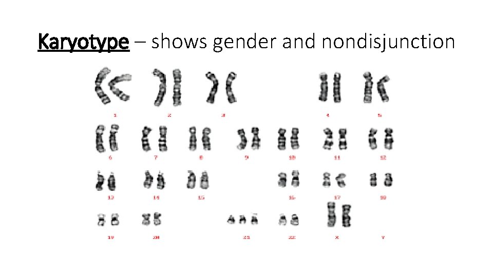 Karyotype – shows gender and nondisjunction 