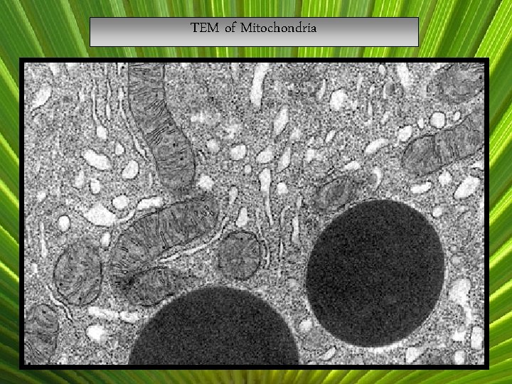 TEM of Mitochondria 