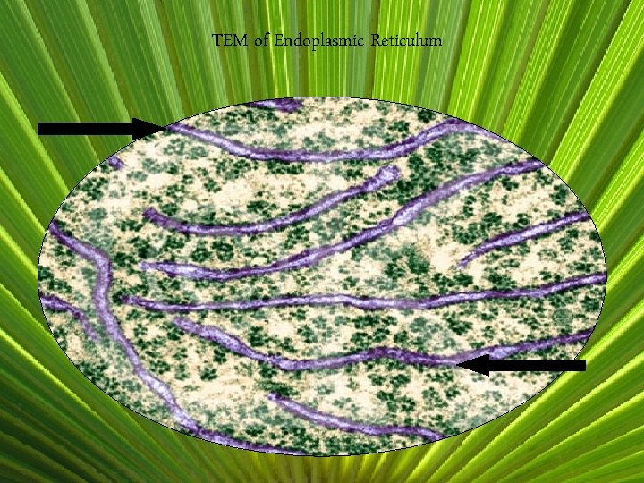 TEM of Endoplasmic Reticulum 