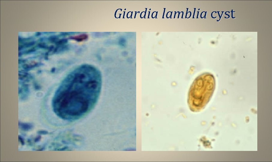 Giardia lamblia cyst 