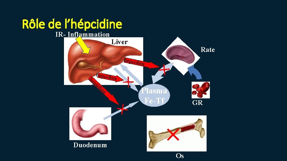 Rôle de l’hépcidine IR- Inflammation Liver Rate hepcid pc ine id in e ×