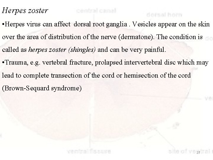 Herpes zoster • Herpes virus can affect dorsal root ganglia. Vesicles appear on the