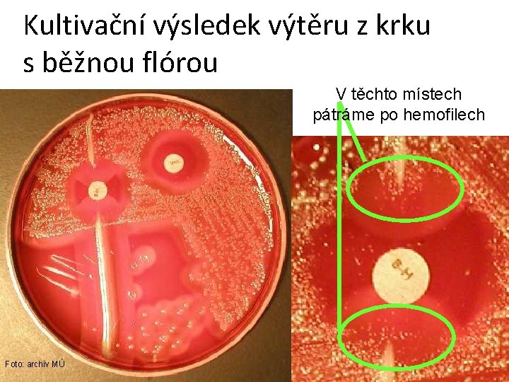 Kultivační výsledek výtěru z krku s běžnou flórou V těchto místech pátráme po hemofilech