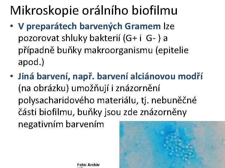 Mikroskopie orálního biofilmu • V preparátech barvených Gramem lze pozorovat shluky bakterií (G+ i