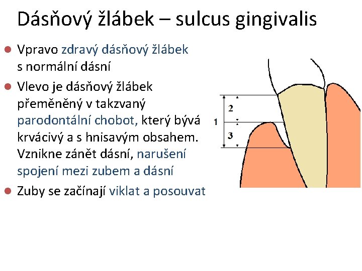Dásňový žlábek – sulcus gingivalis Vpravo zdravý dásňový žlábek s normální dásní l Vlevo