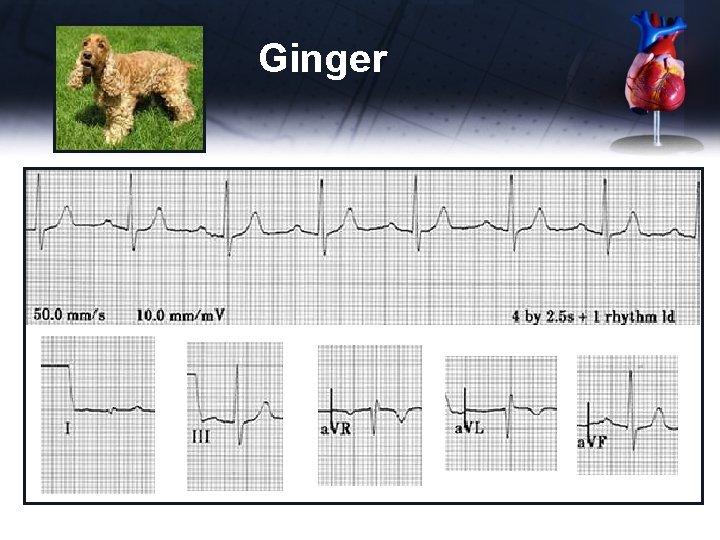 Ginger ECG 
