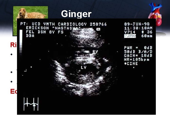 Ginger Right to Left Shunt • Reverse PDA (right to left) – Eisenmeinger’s physiology