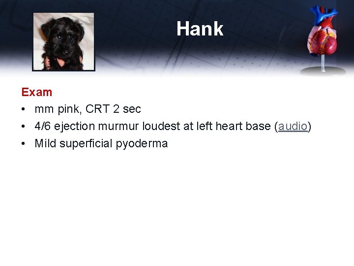 Hank Exam • mm pink, CRT 2 sec • 4/6 ejection murmur loudest at