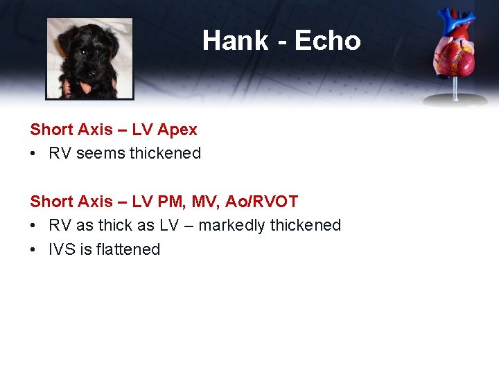 Hank - Echo Short Axis – LV Apex • RV seems thickened Short Axis