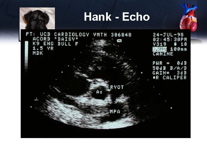 Hank - Echo 