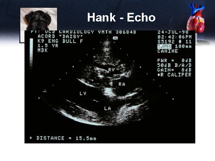 Hank - Echo 