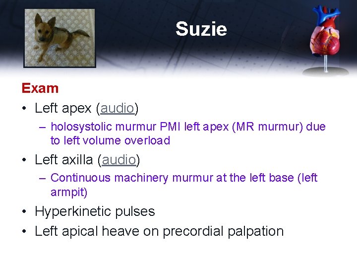 Suzie Exam • Left apex (audio) – holosystolic murmur PMI left apex (MR murmur)