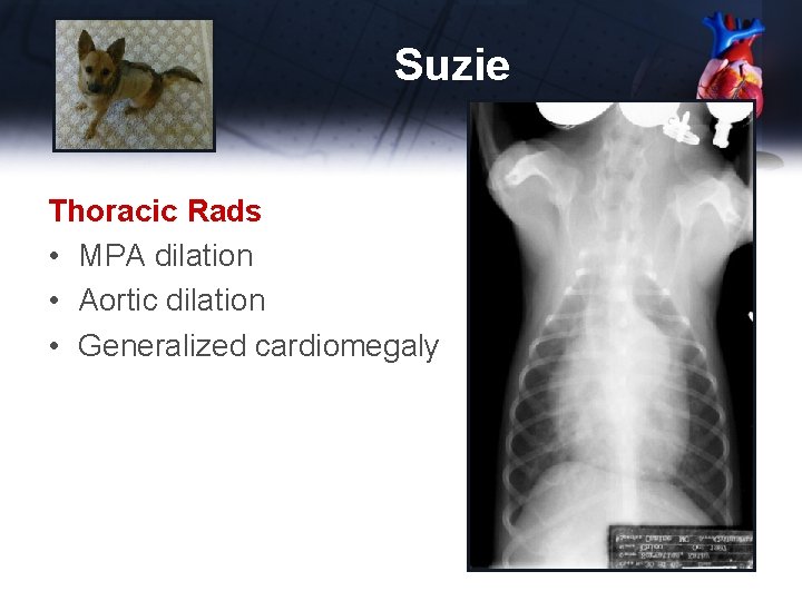 Suzie Thoracic Rads • MPA dilation • Aortic dilation • Generalized cardiomegaly 