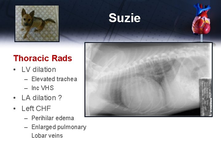 Suzie Thoracic Rads • LV dilation – Elevated trachea – Inc VHS • LA