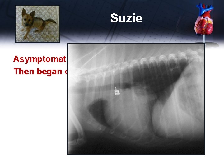 Suzie Asymptomatic for 8 yrs Then began coughing 
