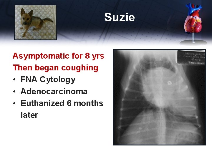 Suzie Asymptomatic for 8 yrs Then began coughing • FNA Cytology • Adenocarcinoma •
