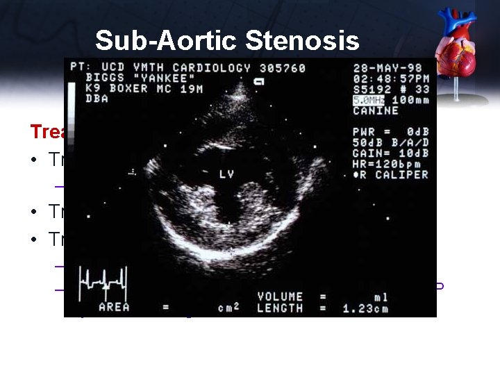 Sub-Aortic Stenosis Treatment • Treat arrhythmia if present – Atenolol 0. 5 mg/kg PO
