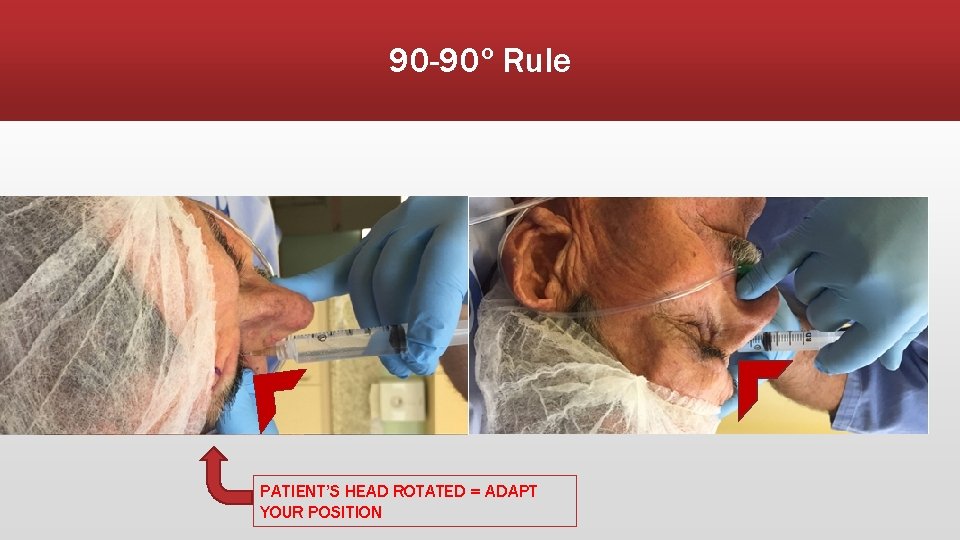 90 -90º Rule PATIENT’S HEAD ROTATED = ADAPT YOUR POSITION 
