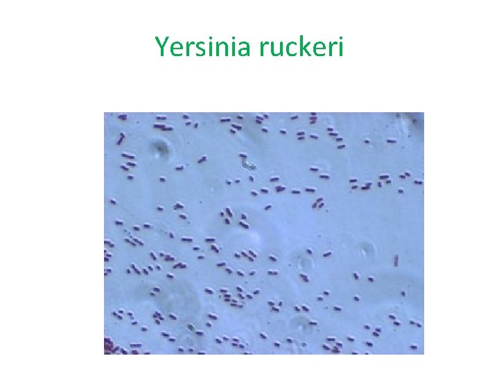Yersinia ruckeri 