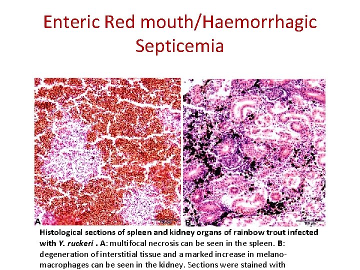 Enteric Red mouth/Haemorrhagic Septicemia Histological sections of spleen and kidney organs of rainbow trout