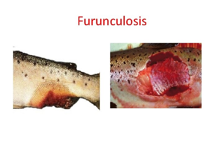 Furunculosis 