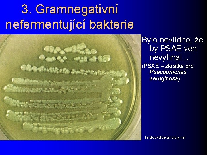 3. Gramnegativní nefermentující bakterie Bylo nevlídno, že by PSAE ven nevyhnal… (PSAE – zkratka