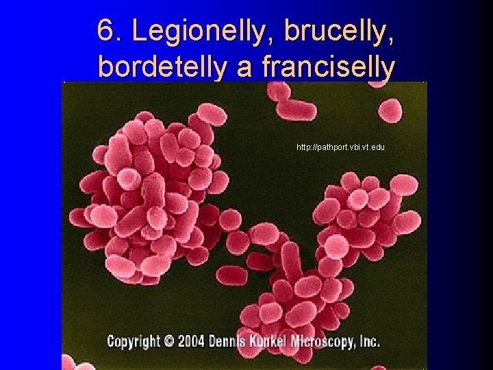 6. Legionelly, brucelly, bordetelly a franciselly http: //pathport. vbi. vt. edu 