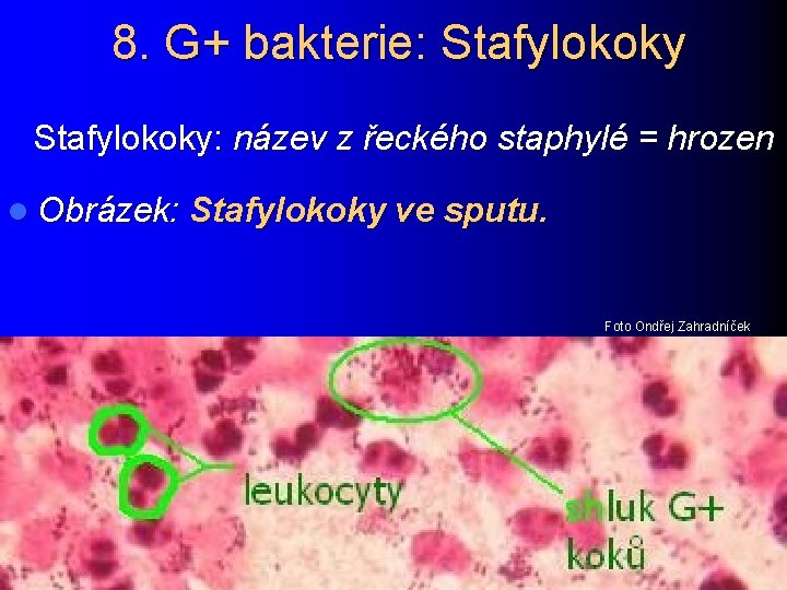 8. G+ bakterie: Stafylokoky: název z řeckého staphylé = hrozen l Obrázek: Stafylokoky ve