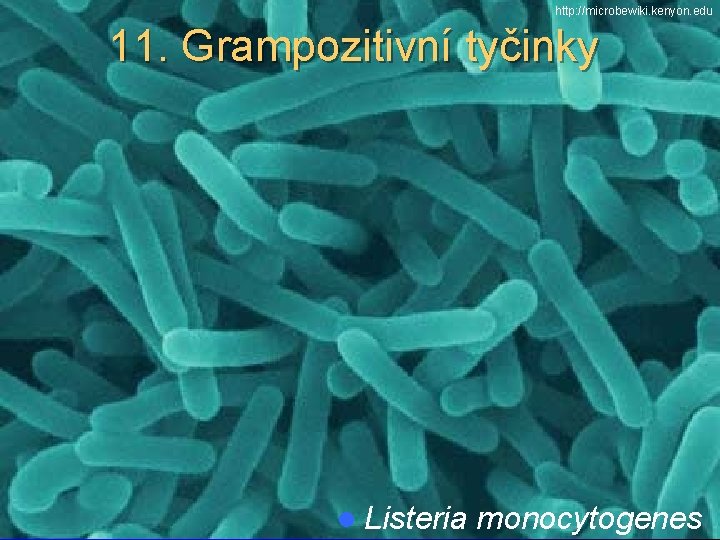 http: //microbewiki. kenyon. edu 11. Grampozitivní tyčinky l Listeria monocytogenes 