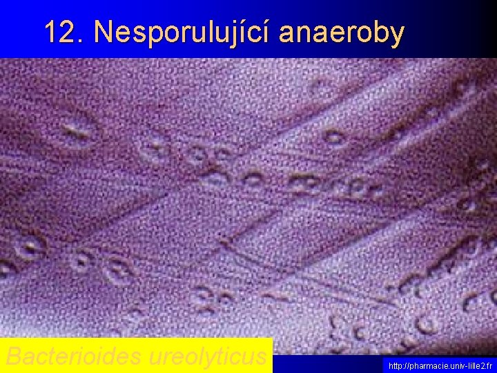 12. Nesporulující anaeroby Bacterioides ureolyticus http: //pharmacie. univ-lille 2. fr 