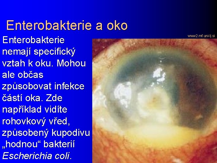 Enterobakterie a oko Enterobakterie nemají specifický vztah k oku. Mohou ale občas způsobovat infekce