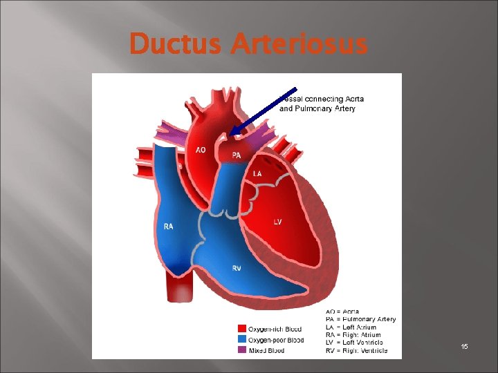 Ductus Arteriosus 15 