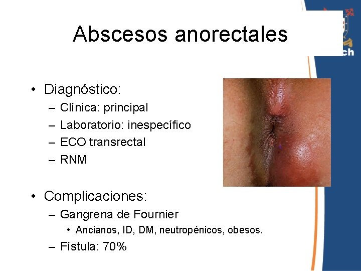 Abscesos anorectales • Diagnóstico: – – Clínica: principal Laboratorio: inespecífico ECO transrectal RNM •